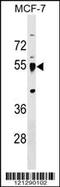 Leucine Rich Repeat Containing 42 antibody, 59-577, ProSci, Western Blot image 