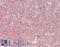 CDKN2A antibody, LS-B14471, Lifespan Biosciences, Immunohistochemistry paraffin image 