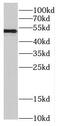 CUGBP Elav-Like Family Member 1 antibody, FNab02071, FineTest, Western Blot image 