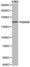 Histone Deacetylase 6 antibody, LS-C192953, Lifespan Biosciences, Western Blot image 