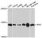 Angiogenin antibody, A13465, ABclonal Technology, Western Blot image 