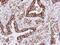 Major Histocompatibility Complex, Class II, DQ Beta 1 antibody, PA5-78003, Invitrogen Antibodies, Immunohistochemistry frozen image 