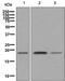 NADH:Ubiquinone Oxidoreductase Subunit S4 antibody, ab137064, Abcam, Western Blot image 