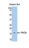 Fibroblast Growth Factor 13 antibody, LS-C314294, Lifespan Biosciences, Western Blot image 