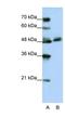 WD Repeat Domain 13 antibody, NBP1-54843, Novus Biologicals, Western Blot image 