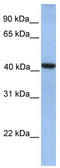 GDP-Mannose Pyrophosphorylase A antibody, TA331024, Origene, Western Blot image 