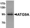 mATG9 antibody, AHP2248, Bio-Rad (formerly AbD Serotec) , Enzyme Linked Immunosorbent Assay image 