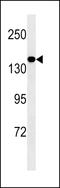 Mediator Complex Subunit 14 antibody, LS-C158121, Lifespan Biosciences, Western Blot image 