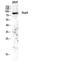 Signal Transducer And Activator Of Transcription 5A antibody, STJ95813, St John