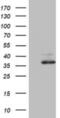 Ornithine Carbamoyltransferase antibody, NBP2-46303, Novus Biologicals, Western Blot image 