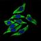 Dynactin Subunit 4 antibody, NBP2-37399, Novus Biologicals, Immunocytochemistry image 