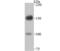 Desmoglein 2 antibody, NBP2-75469, Novus Biologicals, Western Blot image 