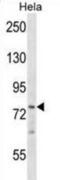 BRF1 RNA Polymerase III Transcription Initiation Factor Subunit antibody, abx028316, Abbexa, Western Blot image 