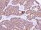 Cytochrome P450 Family 4 Subfamily F Member 11 antibody, NBP2-16082, Novus Biologicals, Immunohistochemistry paraffin image 