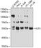 Kruppel Like Factor 5 antibody, 18-896, ProSci, Western Blot image 