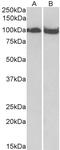 Cyclin-dependent kinase 4 inhibitor B antibody, 43-343, ProSci, Enzyme Linked Immunosorbent Assay image 