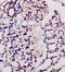 Integrin Linked Kinase antibody, orb10918, Biorbyt, Immunohistochemistry paraffin image 