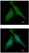 Damage Specific DNA Binding Protein 1 antibody, ab97522, Abcam, Immunocytochemistry image 