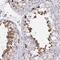 Calmegin antibody, NBP2-48915, Novus Biologicals, Immunohistochemistry paraffin image 