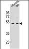 WD Repeat Domain 86 antibody, PA5-48389, Invitrogen Antibodies, Western Blot image 