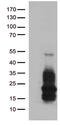 Heparin Binding EGF Like Growth Factor antibody, M01759, Boster Biological Technology, Western Blot image 