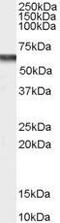 Calcium Voltage-Gated Channel Auxiliary Subunit Beta 4 antibody, GTX89203, GeneTex, Western Blot image 
