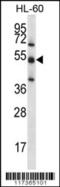 Target Of EGR1, Exonuclease antibody, 56-310, ProSci, Western Blot image 