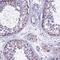 Cysteinyl-TRNA Synthetase 2, Mitochondrial antibody, PA5-59722, Invitrogen Antibodies, Immunohistochemistry frozen image 