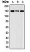 Fibroblast Growth Factor Receptor 1 antibody, MBS821958, MyBioSource, Western Blot image 