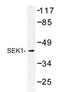 SEK1 antibody, AP20418PU-N, Origene, Western Blot image 