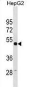 Tubulin Gamma 1 antibody, abx031165, Abbexa, Western Blot image 
