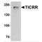 TOPBP1 Interacting Checkpoint And Replication Regulator antibody, TA349061, Origene, Western Blot image 