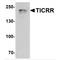 TOPBP1 Interacting Checkpoint And Replication Regulator antibody, TA349061, Origene, Western Blot image 