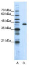 Zinc finger protein 36, C3H1 type-like 2 antibody, TA343640, Origene, Western Blot image 