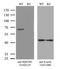 Sequestosome 1 antibody, LS-C796676, Lifespan Biosciences, Western Blot image 