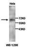 Selectin E antibody, orb77233, Biorbyt, Western Blot image 