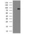 Arachidonate 5-Lipoxygenase antibody, NBP2-46513, Novus Biologicals, Western Blot image 