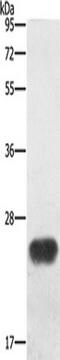 Breast Carcinoma Amplified Sequence 4 antibody, TA351004, Origene, Western Blot image 