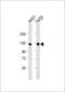 Cadherin 1 antibody, MBS9216854, MyBioSource, Western Blot image 