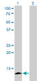 Apolipoprotein C4 antibody, LS-C196674, Lifespan Biosciences, Western Blot image 