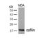 Cofilin 1 antibody, GTX50502, GeneTex, Western Blot image 