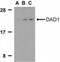 Defender Against Cell Death 1 antibody, NBP1-77197, Novus Biologicals, Western Blot image 