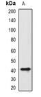 ST8 Alpha-N-Acetyl-Neuraminide Alpha-2,8-Sialyltransferase 4 antibody, abx142076, Abbexa, Western Blot image 