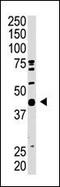 SUMO1 Activating Enzyme Subunit 1 antibody, MBS9205282, MyBioSource, Western Blot image 