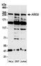 AT-rich interactive domain-containing protein 2 antibody, A302-229A, Bethyl Labs, Western Blot image 