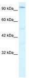 Zinc Finger Homeobox 2 antibody, TA330230, Origene, Western Blot image 