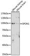 Spondin 1 antibody, LS-C750104, Lifespan Biosciences, Western Blot image 