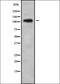 ADAM Metallopeptidase With Thrombospondin Type 1 Motif 1 antibody, orb337964, Biorbyt, Western Blot image 