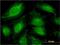 ATP Binding Cassette Subfamily F Member 1 antibody, H00000023-M01, Novus Biologicals, Immunocytochemistry image 