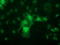Phenylethanolamine N-methyltransferase antibody, LS-C172947, Lifespan Biosciences, Immunofluorescence image 